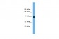 GNAI3 antibody - middle region